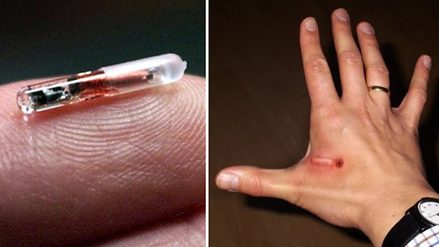 RFID microchip implants 