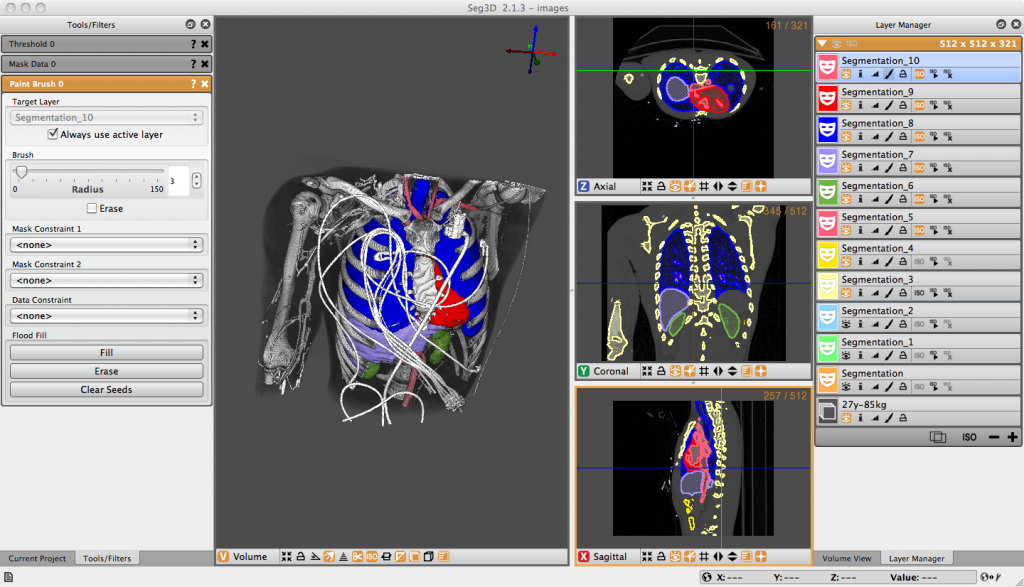 Seg3D - biomedical computing software